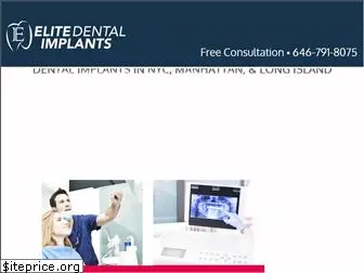 elitedentalimplants.com