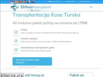 elithairtransplant.net