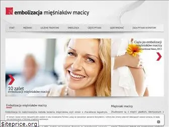 embolizacjamiesniakowmacicy.pl