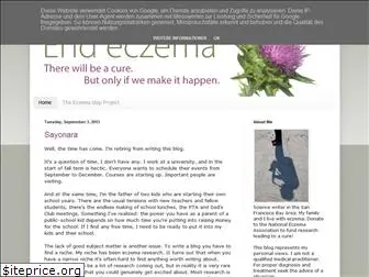 endeczema.blogspot.com