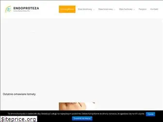 endoproteza.info