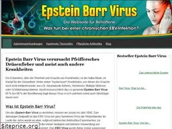 epstein-barr-virus24.de