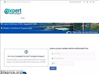 experthairtransplant.com