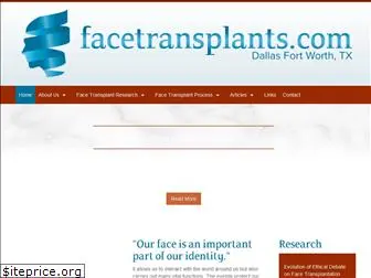 facetransplants.com