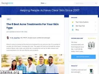 facingacne.com