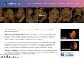 fetalfotos.com.au