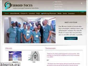 fibroidfocus.com