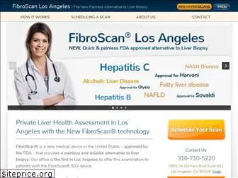 fibroscanlosangeles.com