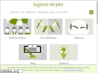 foro-injertodepelo.com