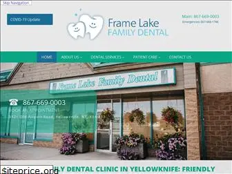 framelakefamilydental.ca