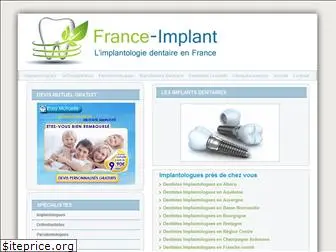 france-implant.fr