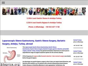 gastric-sleeve-turkey.com
