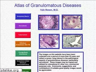 granuloma.homestead.com