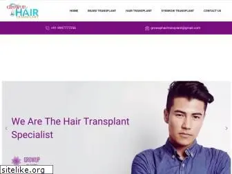 growuphairtransplant.com