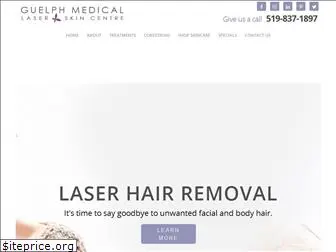 guelphlaser.ca