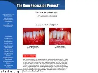 gumrecession.com