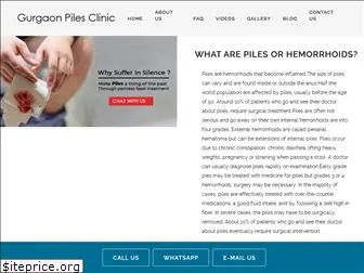 gurgaonpilesclinic.com