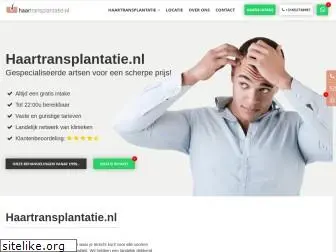 haartransplantatie.nl