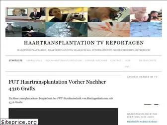 haartransplantation-tv-reportage.at