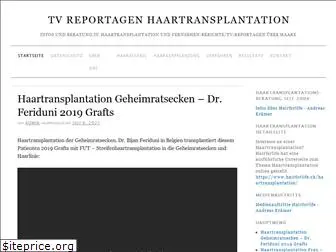 haartransplantation-tv-reportage.ch