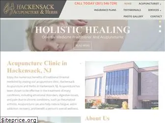 hackensackacu.com