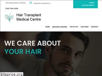 hair-transplant.ca