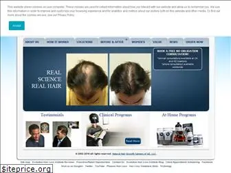 hairgrowthcenters.com