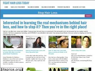 hairlossguides.info