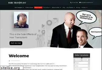 hairtransplant.com