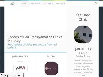 hairtransplantationreviews.com