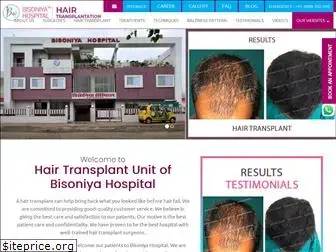hairtransplantbhopal.com