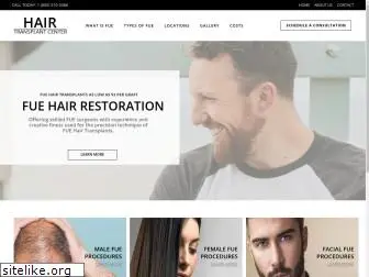 hairtransplantcenter.com