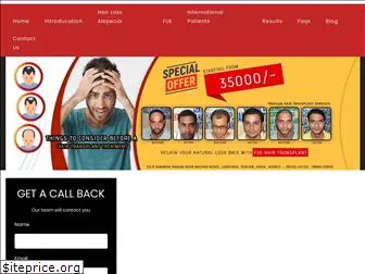 hairtransplantcenterindia.com