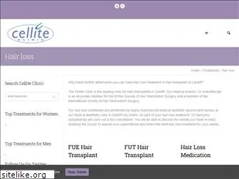 hairtransplantclinic.co.uk