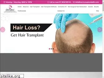 hairtransplantdelhi.com