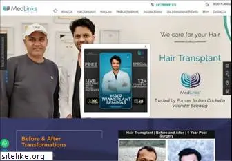 hairtransplantdelhi.org