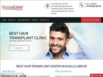 hairtransplantkualalumpur.com