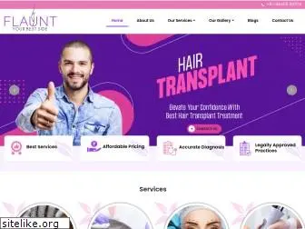 hairtransplantmangalore.com