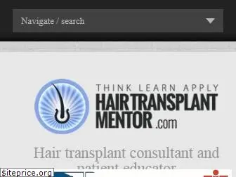 hairtransplantmentor.com