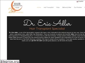 hairtransplantpuertorico.com