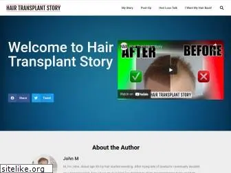 hairtransplantstory.co.uk