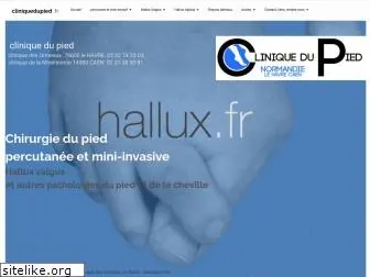 hallux.fr