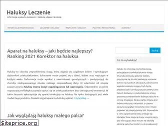 haluksy-leczenie.pl