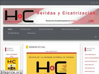 heridasycicatrizacion.es