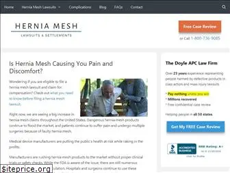 herniameshlawsuit.org