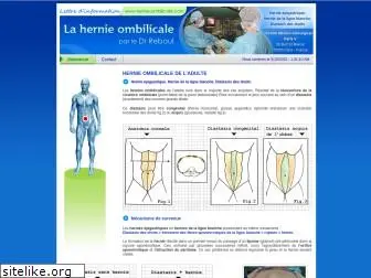hernie-ombilicale.com