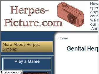 herpes-picture.com