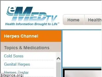 herpes.emedtv.com