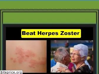 herpeszostersymptoms.com