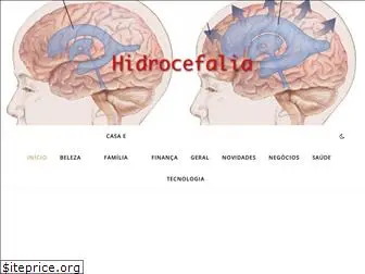 hidrocefalia.com.br
